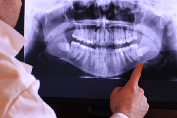 Best Emergency Root Canal Treatment in South Houston, TX